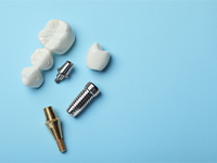 Dental implant and dental bridge parts set against a blue background