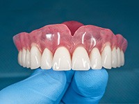 Examples of dentures in Jonesboro