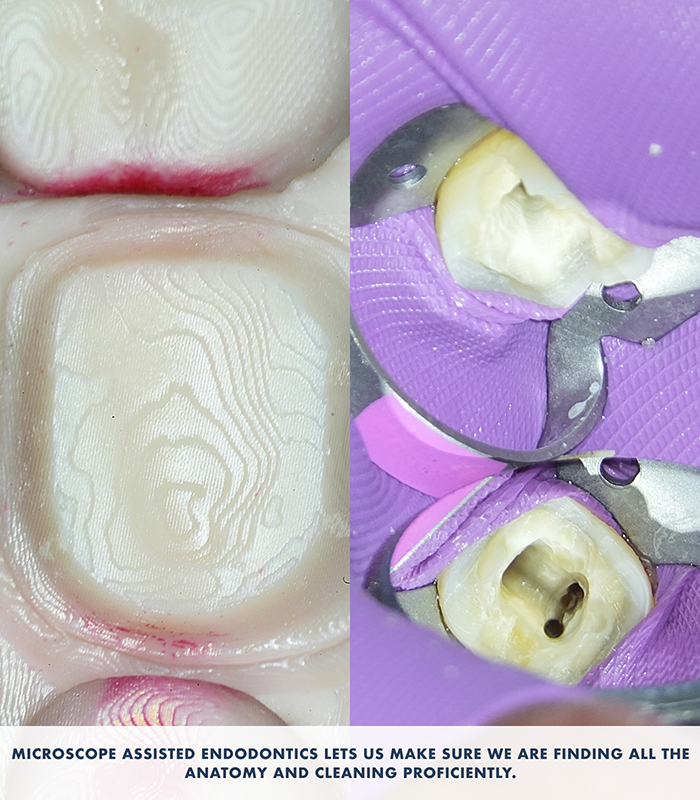 Dentist examining patient using dental microscope