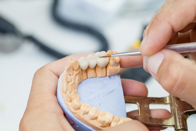 A lab technician working on a dental bridge